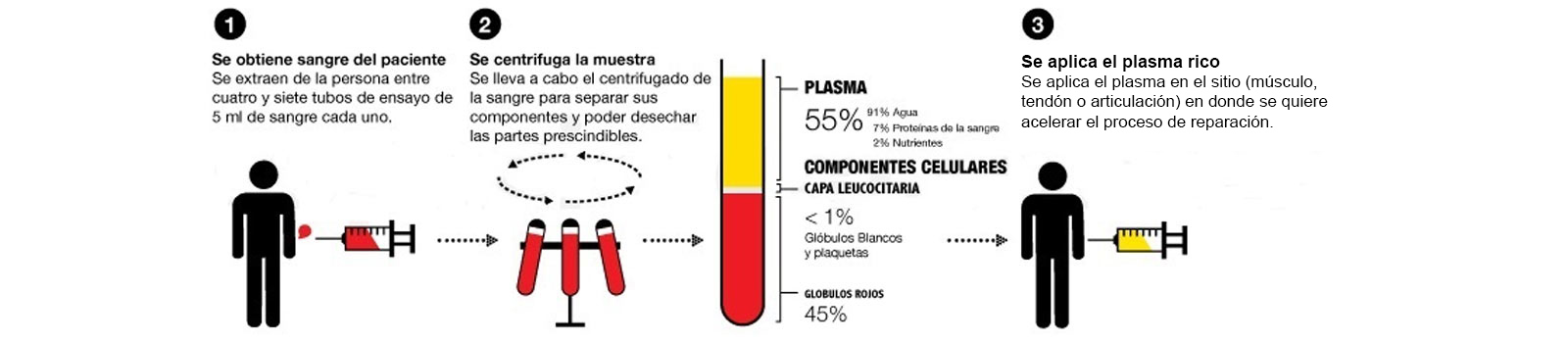 aplicacion de plaquetas en tratamiento